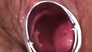 ஜெர்க்கிங் மாதிரி ஆகாதவனுக்கு தனியா கொடுக்கிறது